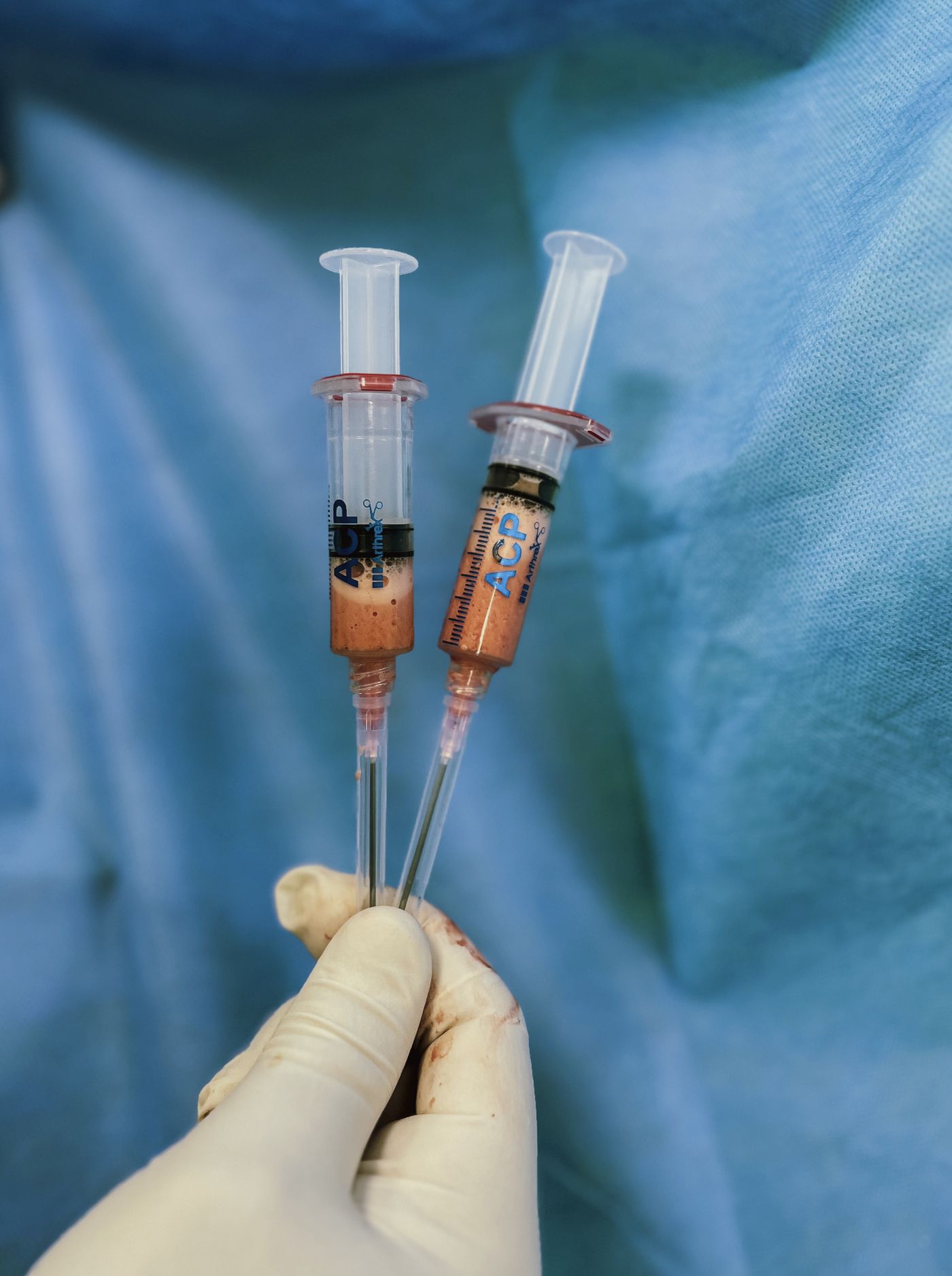 Gloved medical hand holding syringes